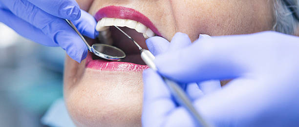 Best Emergency Dental Care for Abscessed Tooth in Hanover Park, IL